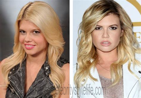 chanel west coast before surgery|Chanel West Coast Revealed The Cosmetic。